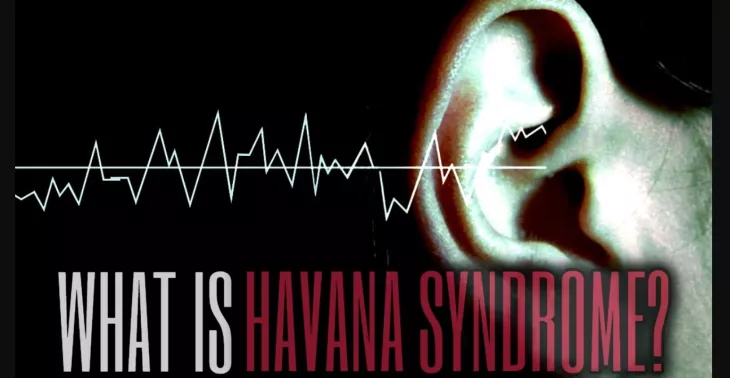 Havana Syndrome