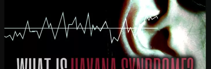 Havana Syndrome